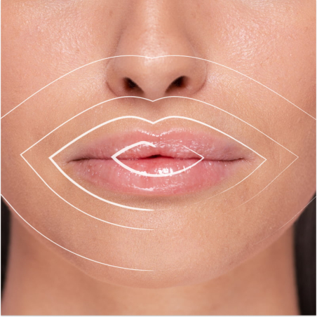 Hyaluronic Lip Volumiser