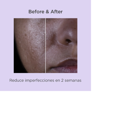 Isdinceutics Serum Salicylic Renewal