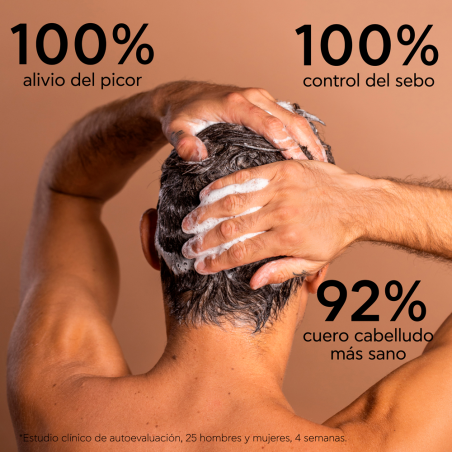 Shampoo Antiforfora Oleoso