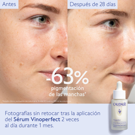 VINOPERFECT SÉRUM ECLAT ANTI-TACHES 30ML