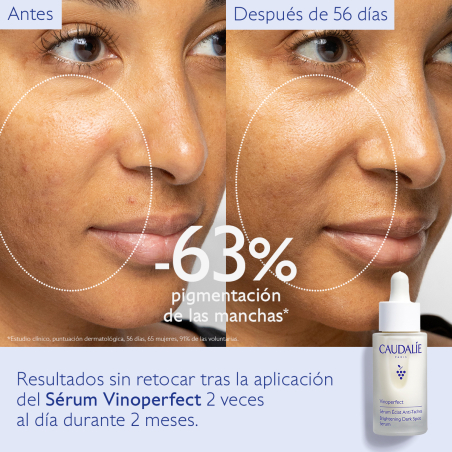 VINOPERFECT SÉRUM ECLAT ANTI-TACHES 30ML