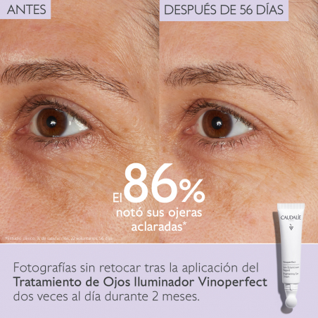 VINOPERFECT ILUMINADOR TRATAMENTO OCULAR